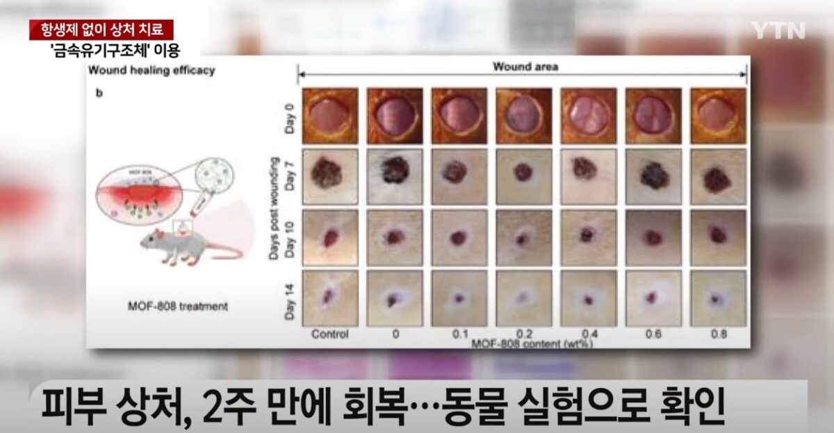 [과학 한스푼] 항생제 없이도 덧나지 않고 피부 상처 치료한다